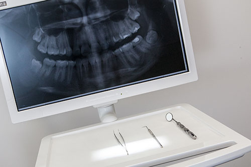 Oralchirurgie - Fachzahnarzt für Oralchirurgie in 52525 Heinsberg